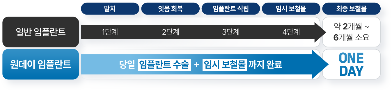 일반임플란트 원데이 임플란트 비교 표
