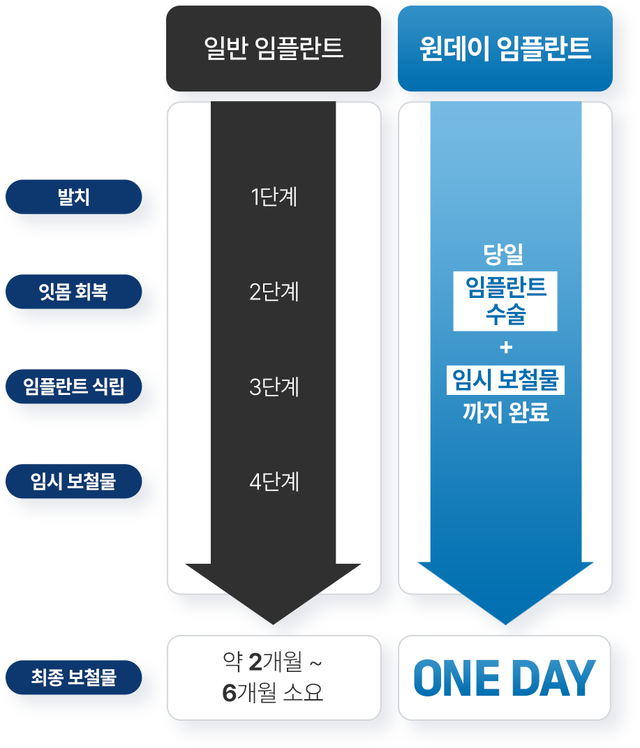 일반임플란트 원데이 임플란트 비교 표