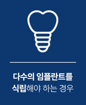 다수의 임플란트를 식립해야 하는 경우